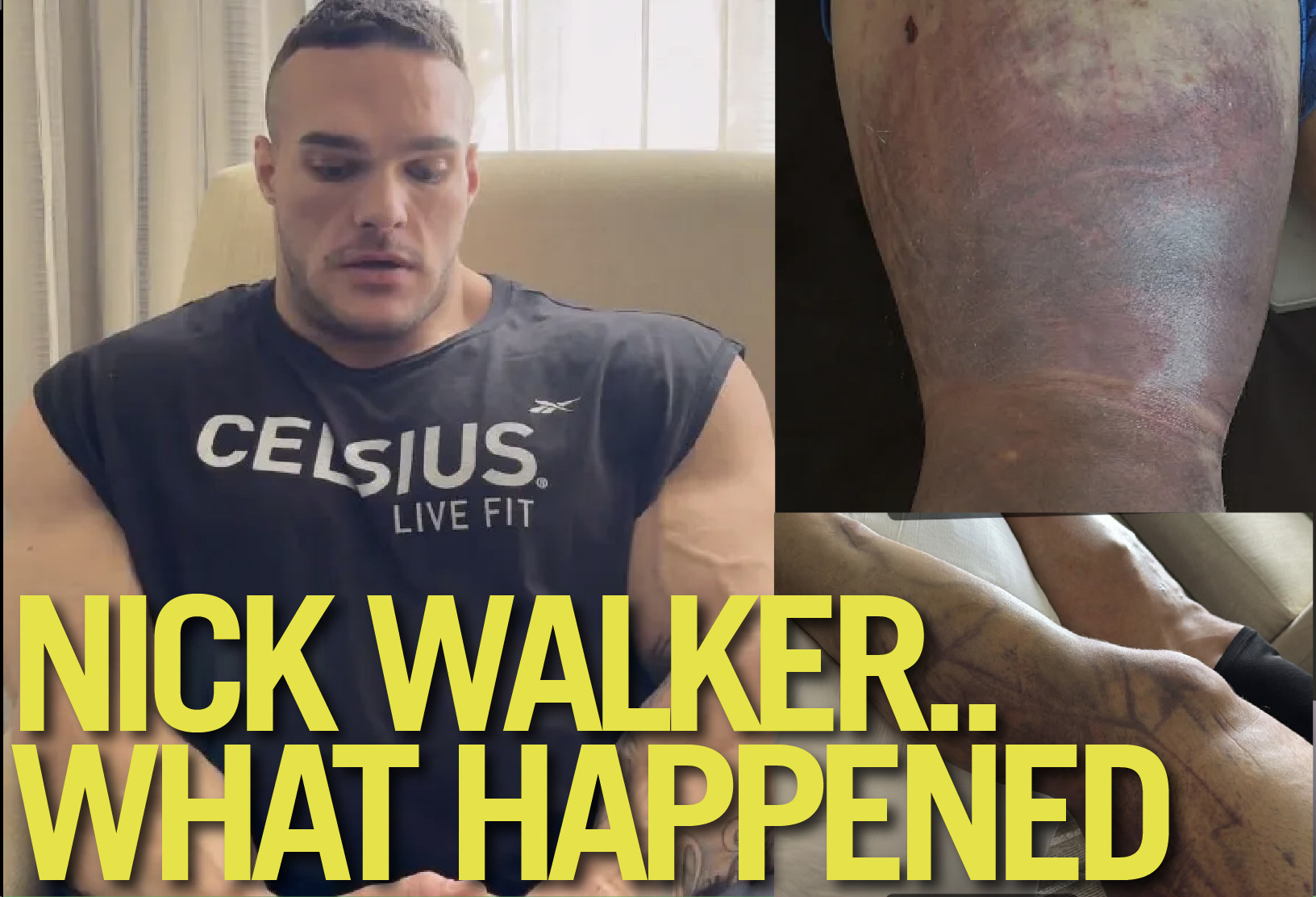Will Nick Walker be Affected by What Happened to him?